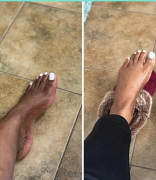 Dark Knuckles Oil – SHOPSKINCLINIC