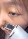 Ultrasonic Skin Scrubber