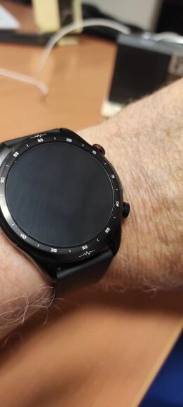 Diabetes Watch