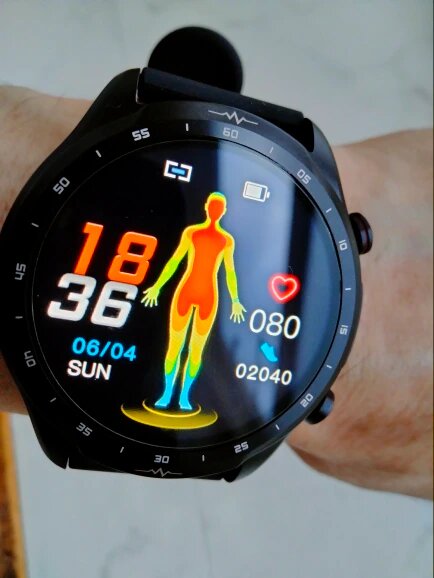 Diabetes Watch