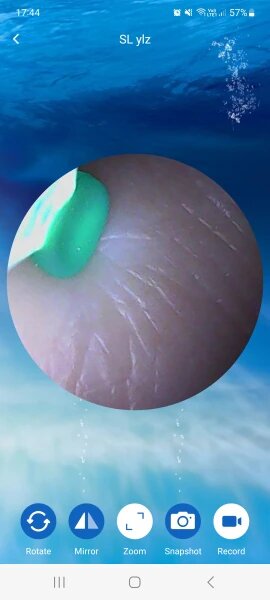 SmartScope Visual Ear Cleaner