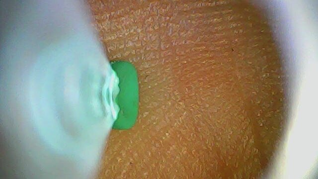 SmartScope Visual Ear Cleaner