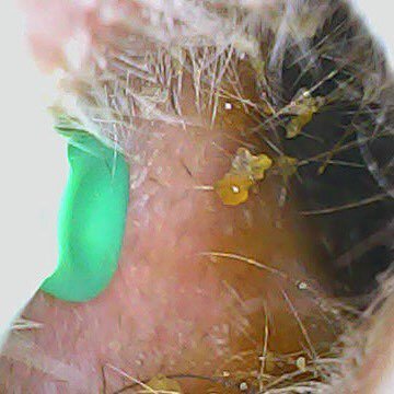SmartScope Visual Ear Cleaner